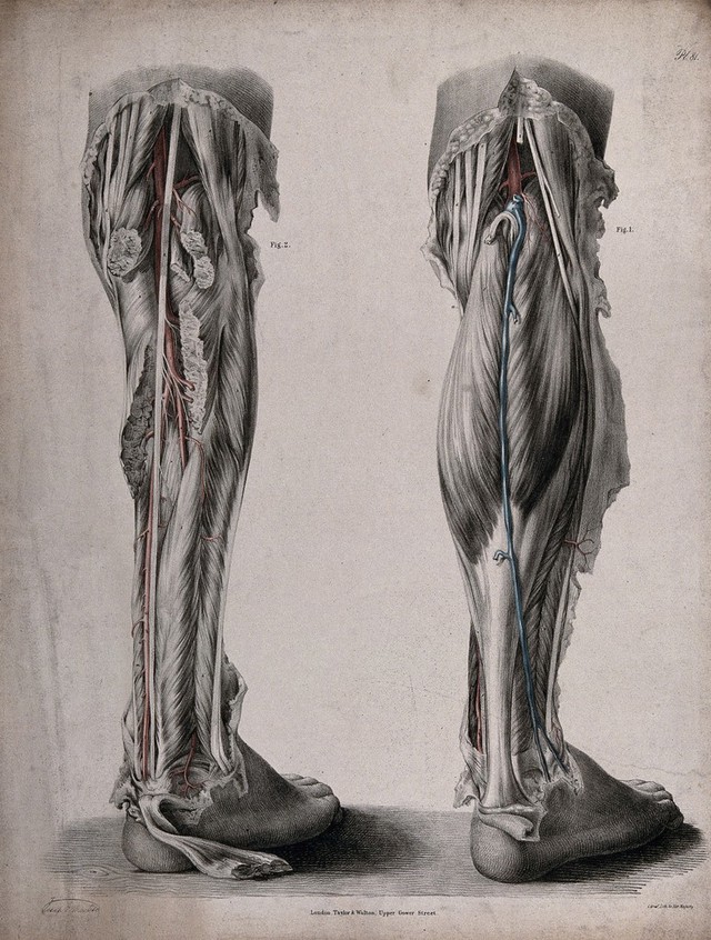 digitised image 1